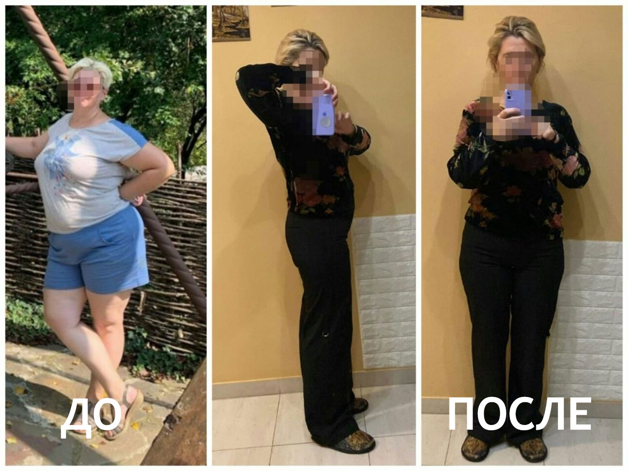 Медовый массаж спины и живота ДО и ПОСЛЕ