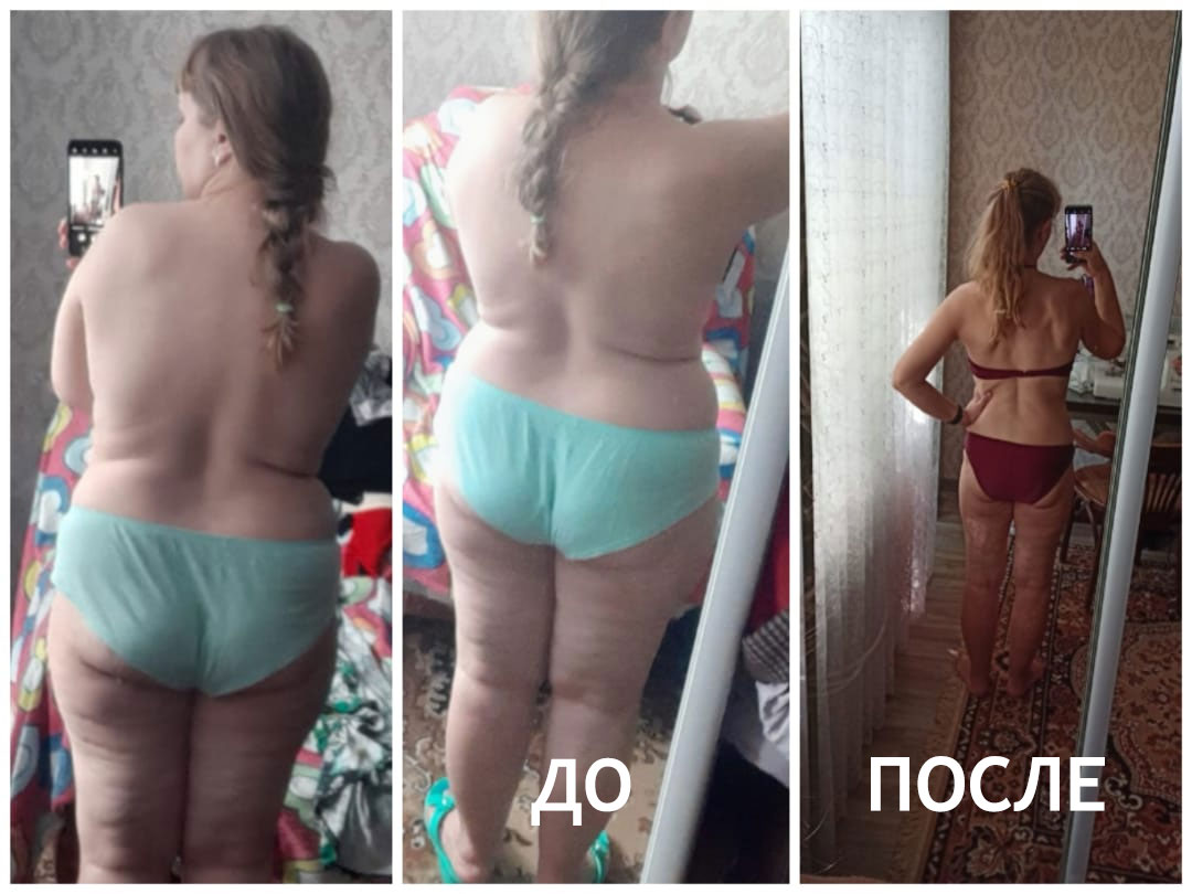 Медово-кофейный массаж ДО и ПОСЛЕ